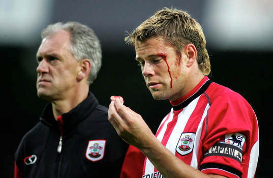 James Beattie, Southampton slog ihop skallen med Edier