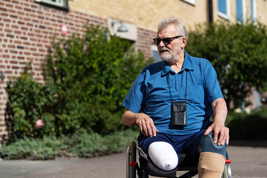 Krister Broman, som har fått amputera båda benen på