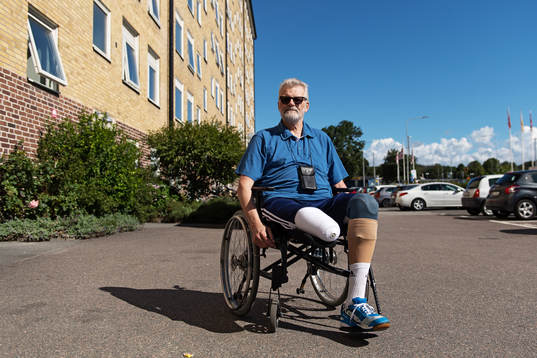Krister Broman, som har fått amputera båda benen på