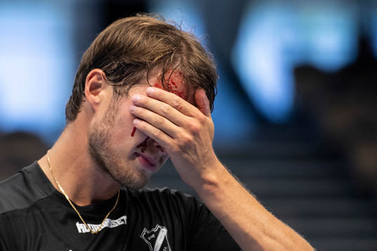 Fagerhult Habo Jesper Ekström med blod i ansikte