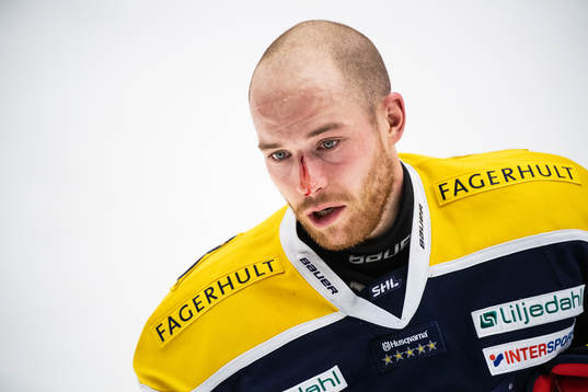 s Filip Sandberg blöder